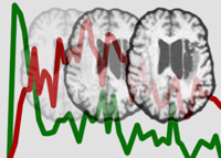 The lab studies effects of stroke on brain region activation.